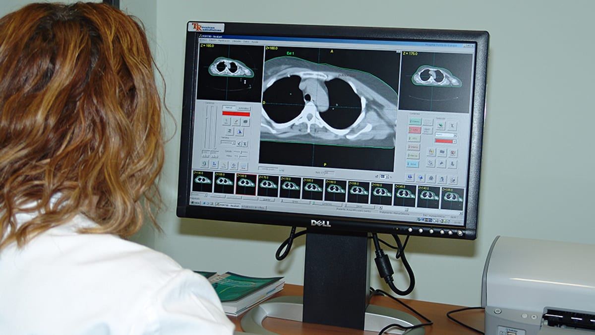 Profesional médica observando pantalla con imágenes de tomografía computarizada de tórax